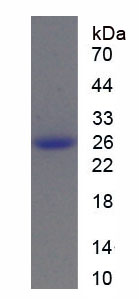 Recombinant Tuberous Sclerosis Protein 1 (TSC1)