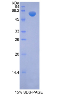 Recombinant N-Acetyl Alpha-D-Glucosaminidase (NAGLU)