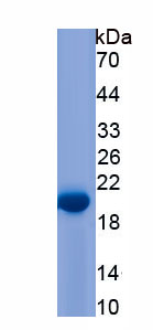 Recombinant Procollagen C Proteinase Enhancer 2 (PCPE2)