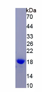 Recombinant Calcium Channel, Voltage Dependent, N-Type, Alpha 1B Subunit (CACNa1B)