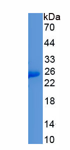 Recombinant V-Ki-Ras2 Kirsten Rat Sarcoma Viral Oncogene Homolog (KRAS)
