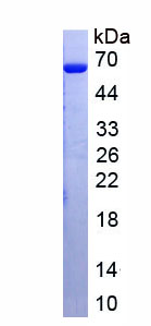 Recombinant Insulin Promoter Factor 1 (IPF)