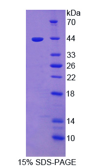 Recombinant A Disintegrin And Metalloproteinase With Thrombospondin 5 (ADAMTS5)