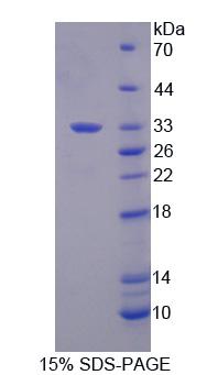 Recombinant Dicer 1, Ribonuclease Type III (DICER1)