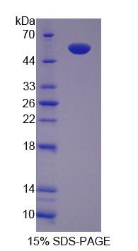 Recombinant Chaperonin Containing TCP1, Subunit 2 (CCT2)