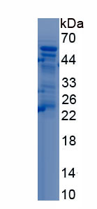 Recombinant Nuclear Factor, Erythroid Derived 2 Like Protein 2 (NFE2L2)