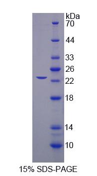 Recombinant Splicing Factor 3B Subunit 3 (SF3B3)