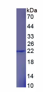 Recombinant Retinol Binding Protein 5, Cellular (RBP5)