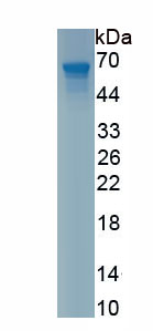 Recombinant Peptidase Inhibitor 16 (PI16)