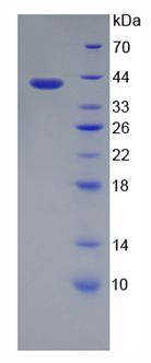 Recombinant Zymogen Granule Protein 16 Homolog B (ZG16B)