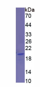 Recombinant Sialic Acid Binding Ig Like Lectin 14 (SIGLEC14)