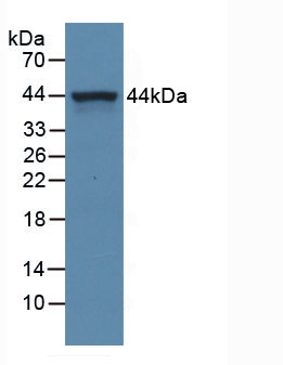 Active Complement Component 5a C5a Apa388hu61 Homo Sapiens Human Cloud Clone Corp Ccc