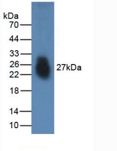 Active Fibronectin Type III Domain Containing Protein 5 (FNDC5)