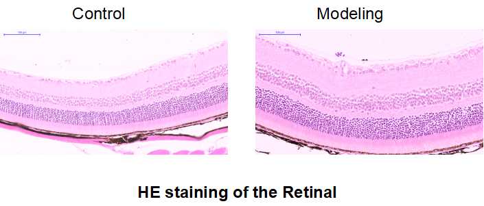 Rat Model for Diabetic Retinopathy (DR)