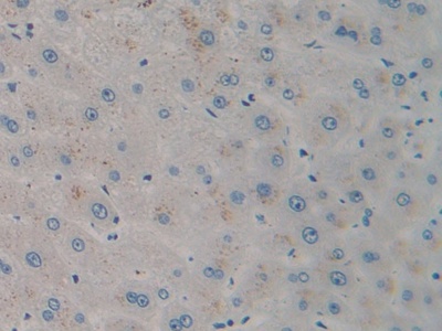 Monoclonal Antibody to Stromal Cell Derived Factor 1 (SDF1)