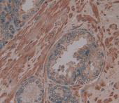 Monoclonal Antibody to Procollagen I N-Terminal Propeptide (PINP)