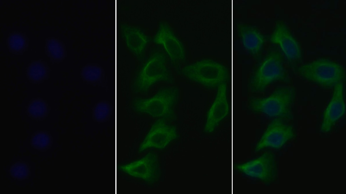 Monoclonal Antibody to Tubulin Beta (TUBb)