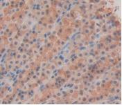 Monoclonal Antibody to Interleukin 33 (IL33)