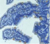 Polyclonal Antibody to Angiopoietin 2 (ANGPT2)