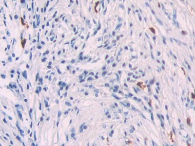 Polyclonal Antibody to Platelet Factor 4 (PF4)