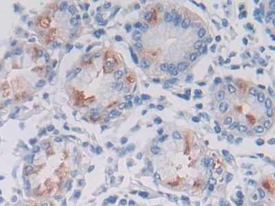 Polyclonal Antibody to Latrophilin 3 (LPHN3)