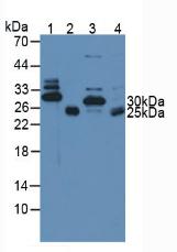 Polyclonal Antibody to Troponin I Type 3, Cardiac (TNNI3)