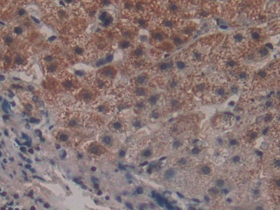 Polyclonal Antibody to Peroxisome Proliferator Activated Receptor Alpha (PPARa)