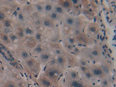 Polyclonal Antibody to Peroxisome Proliferator Activated Receptor Alpha (PPARa)