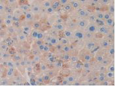 Polyclonal Antibody to Clusterin (CLU)