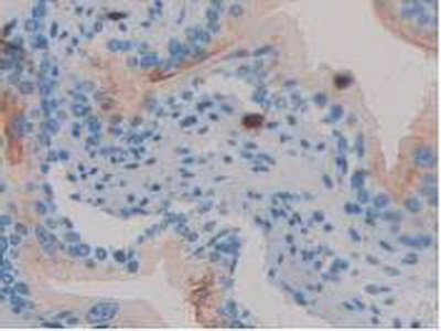 Polyclonal Antibody to Clusterin (CLU)