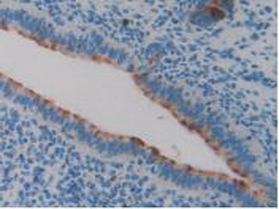 Polyclonal Antibody to Clusterin (CLU)
