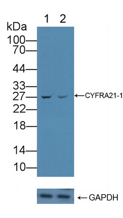 Polyclonal Antibody to Cytokeratin Fragment Antigen 21-1 (CYFRA21-1)