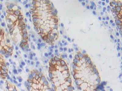 Polyclonal Antibody to Cytokeratin Fragment Antigen 21-1 (CYFRA21-1)