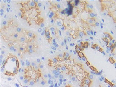 Polyclonal Antibody to Cytokeratin Fragment Antigen 21-1 (CYFRA21-1)