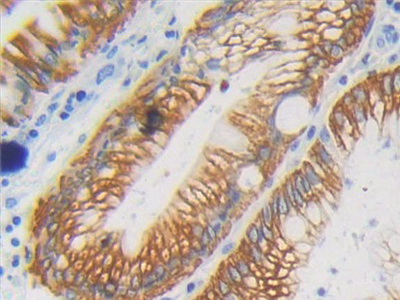 Polyclonal Antibody to Cytokeratin Fragment Antigen 21-1 (CYFRA21-1)