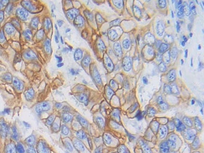 Polyclonal Antibody to Cytokeratin Fragment Antigen 21-1 (CYFRA21-1)