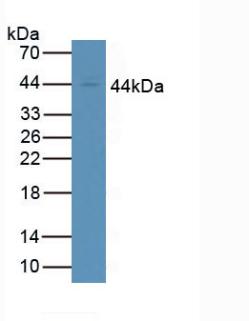 Polyclonal Antibody to Cluster Of Differentiation 64 (CD64)