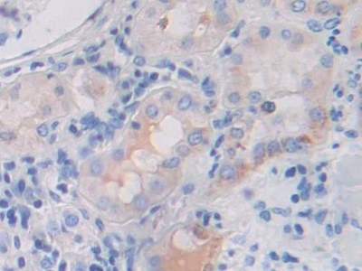 Polyclonal Antibody to Fibroblast Growth Factor Receptor 3 (FGFR3)