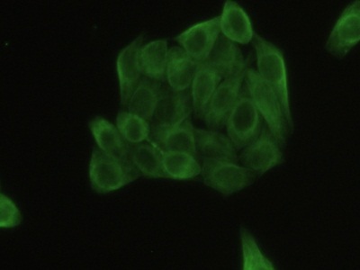 Polyclonal Antibody to Tubulin Beta (TUBb)