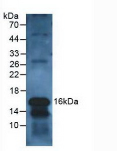 Polyclonal Antibody to Charcot Leyden Crystal Protein (CLC)