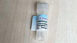 Loading Control Antibodies